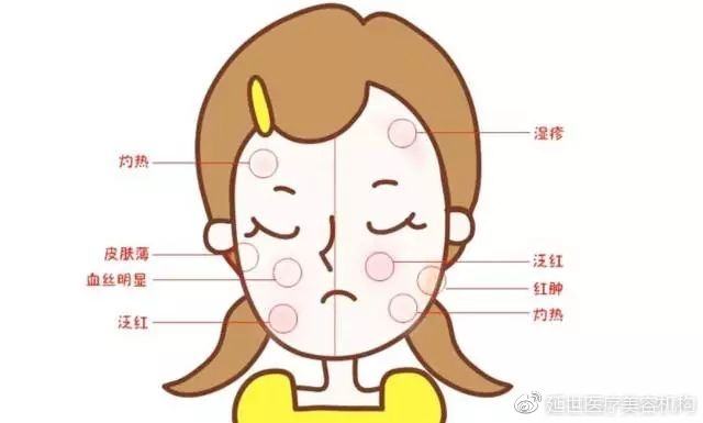 增厚角质层的方法小妙招,怎么才能增厚角质层