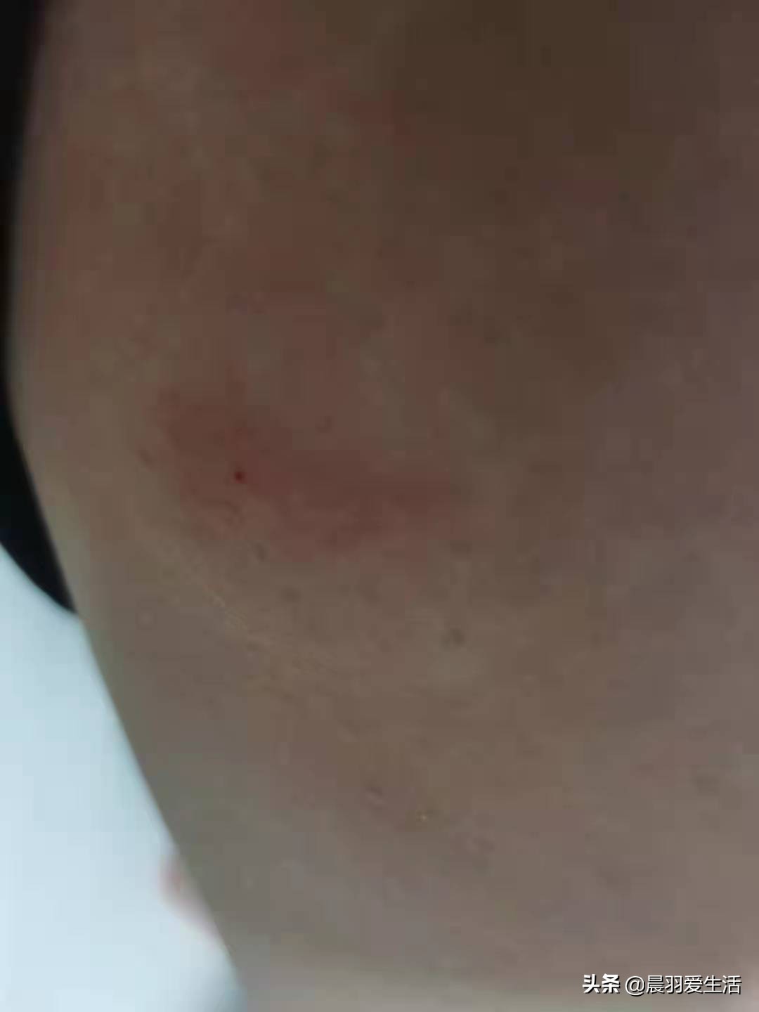 黑蚂蚁毒性大还是红蚂蚁毒性大,红蚂蚁和黑蚂蚁的哪个毒性强