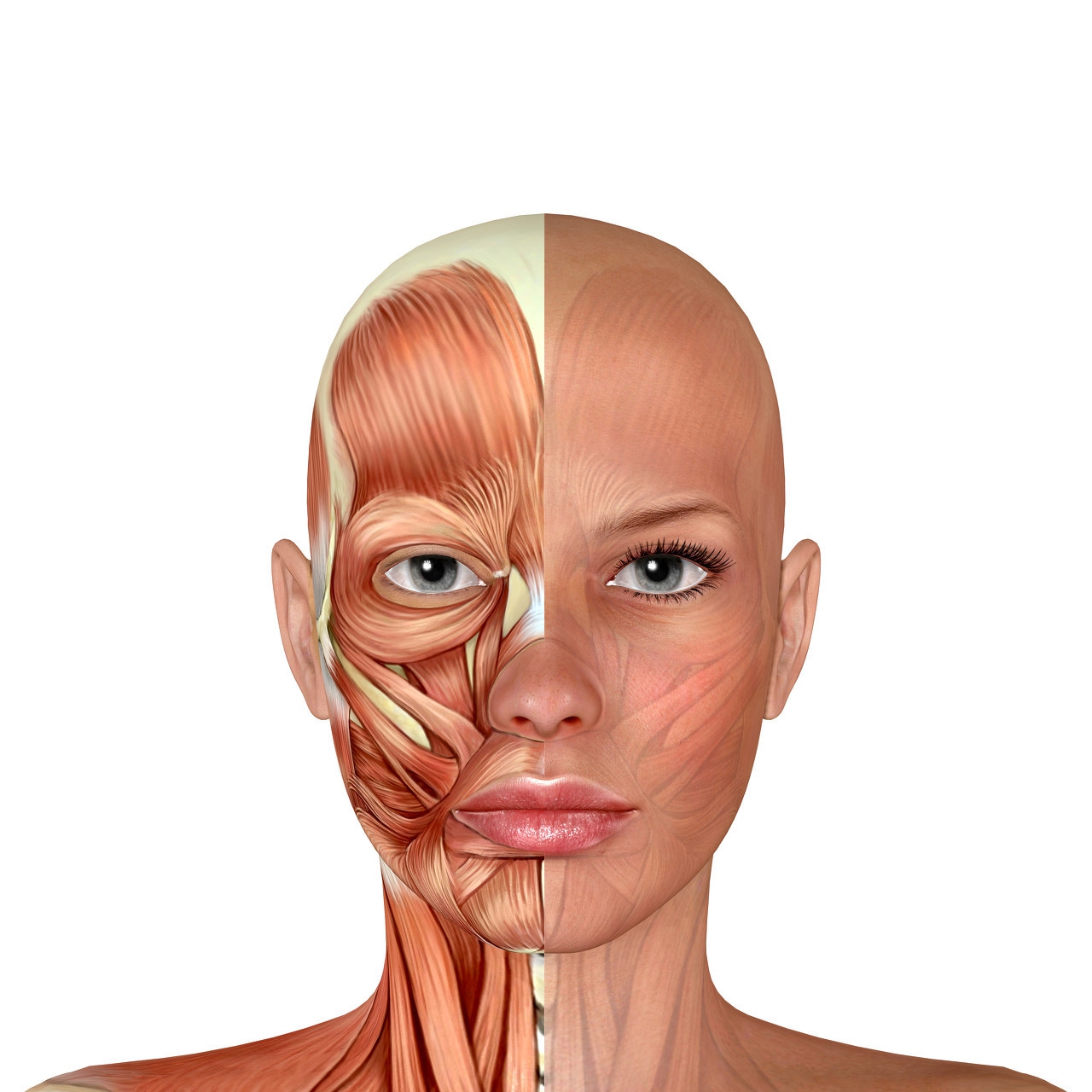 拉皮手术真人讲述案例,拉皮手术真实恢复期案例