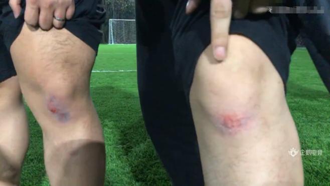 德云色打职业,德云色比赛转圈