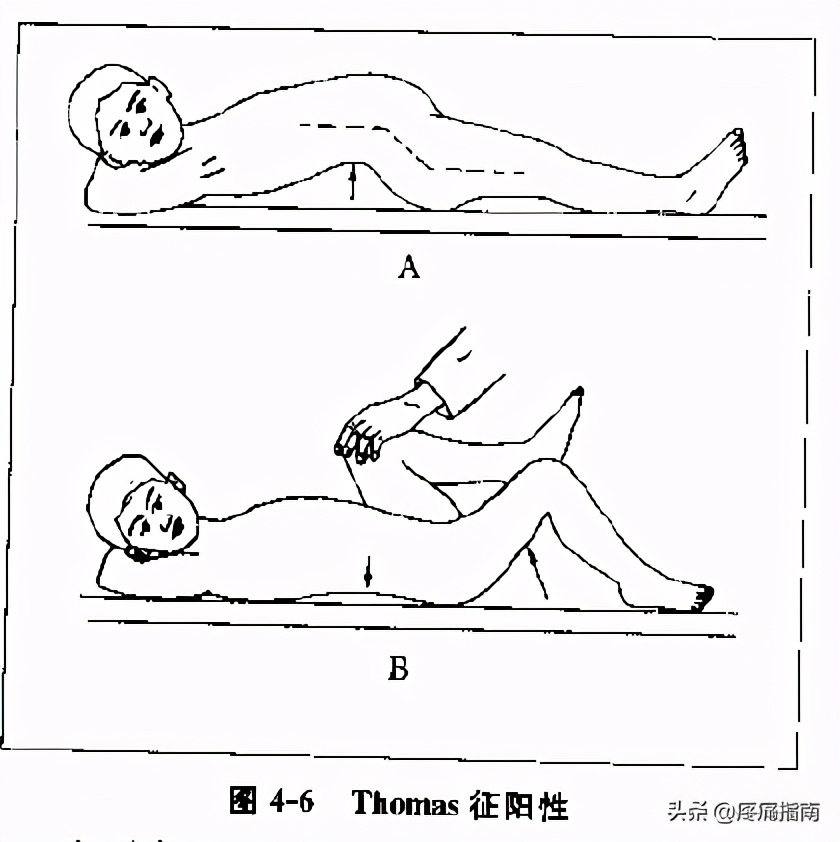 夏天无注射液能治疗骨头坏死吗,骨头坏死用针刀镜有用么