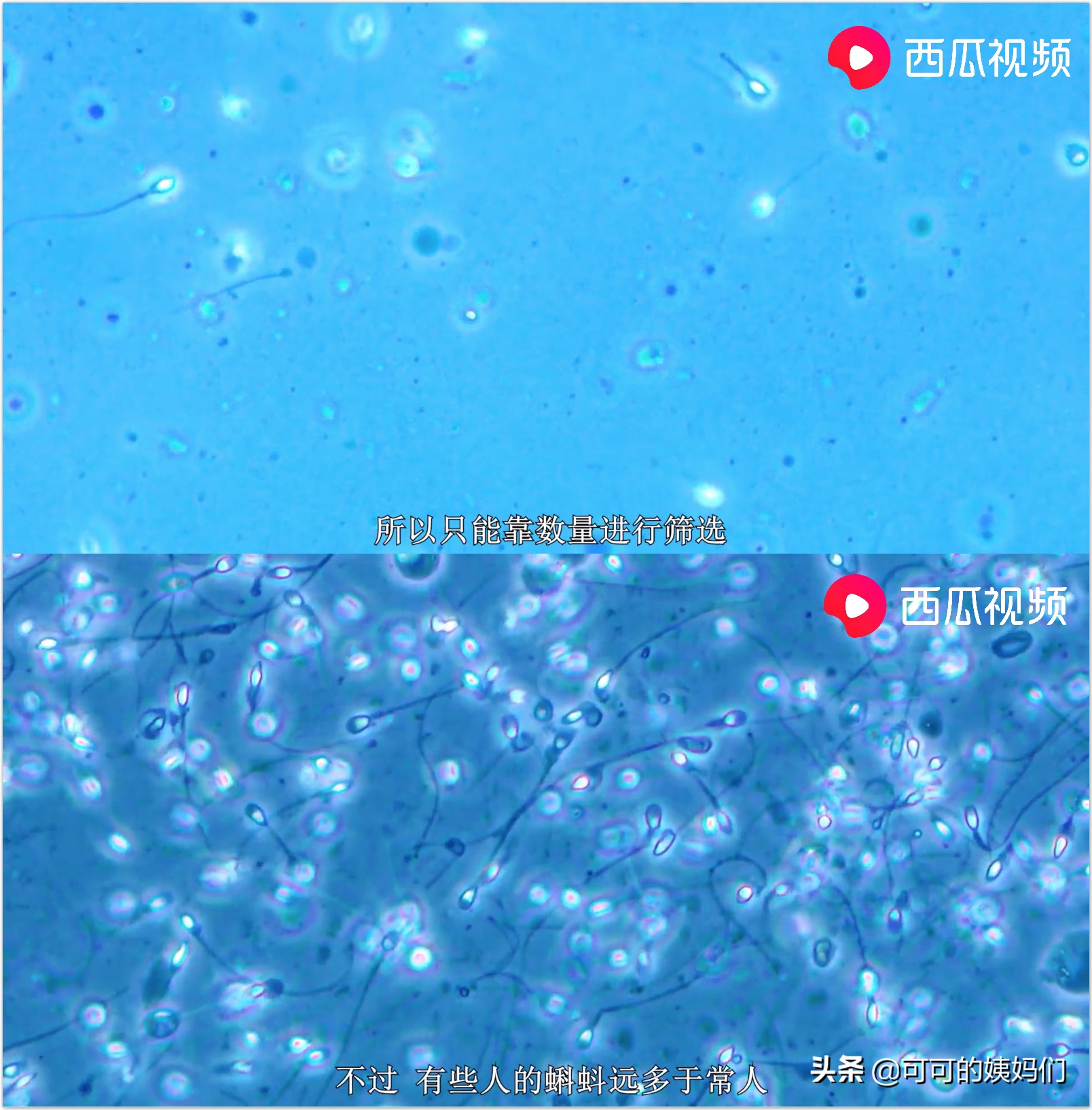 受孕、连体婴、唇裂...西瓜视频揭秘：五大不可思议的繁衍冷知识