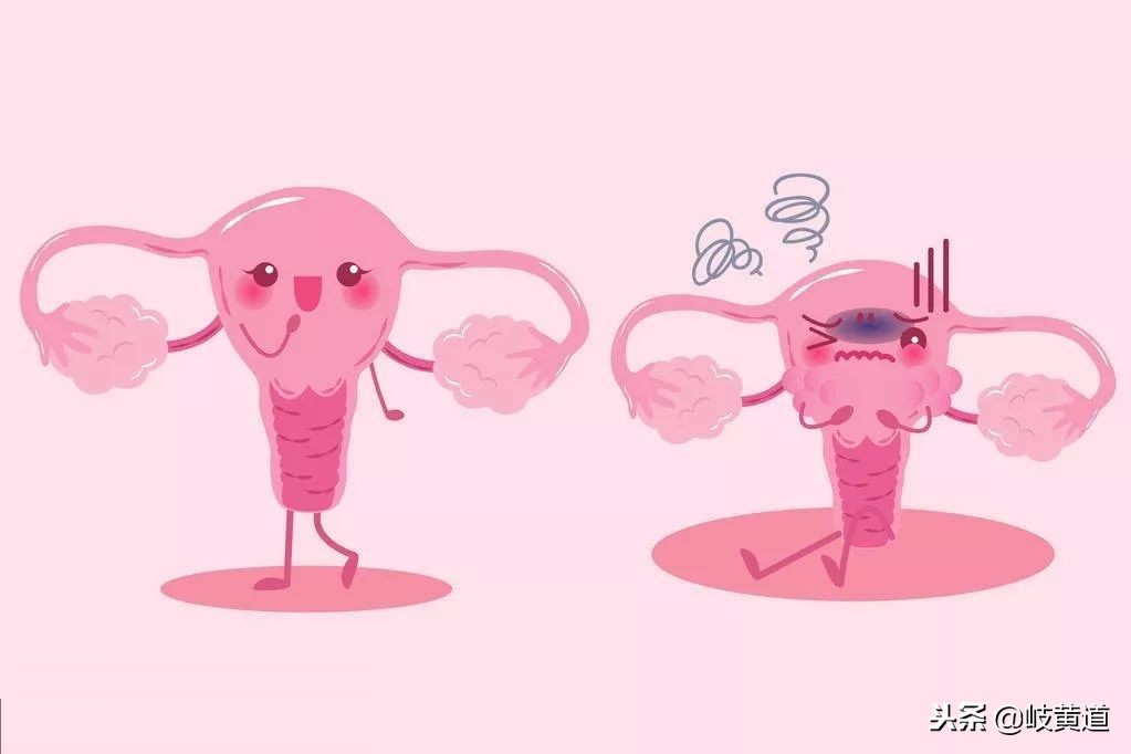 哪些不良卫生习惯会导致外阴瘙痒呢？