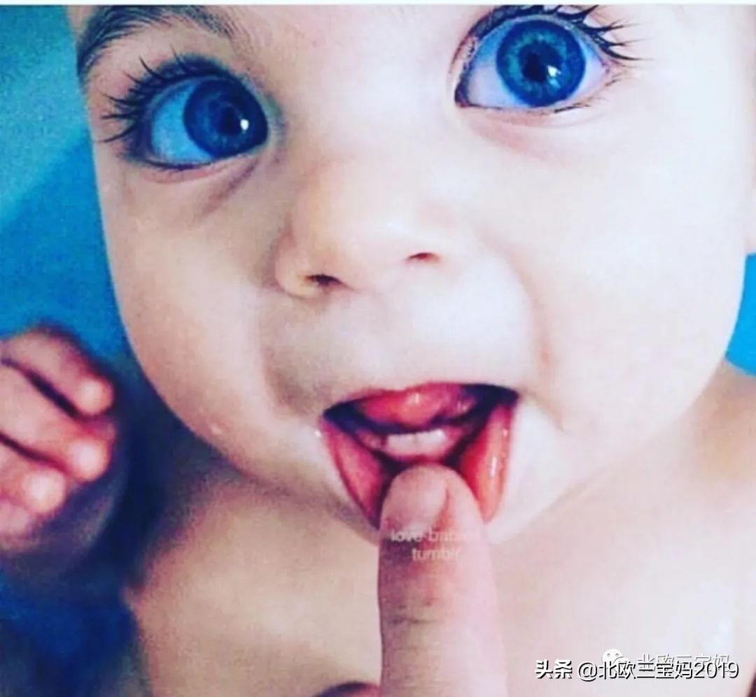 3岁儿童全麻做根管有影响吗,宝宝捆绑治疗蛀牙