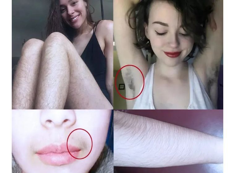 j-style脱毛仪,j-style脱毛仪怎么样