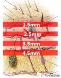 40岁的女人整形手术,40岁女性适合的身体整形医美项目