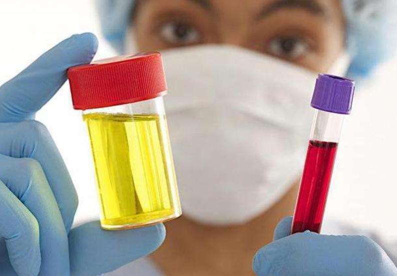 女性晨起第一泡尿是怎么回事,女性早晨第一泡尿