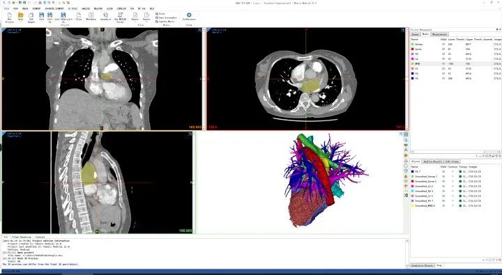 大学生如何选购笔记本,计算机专业大学生笔记本推荐