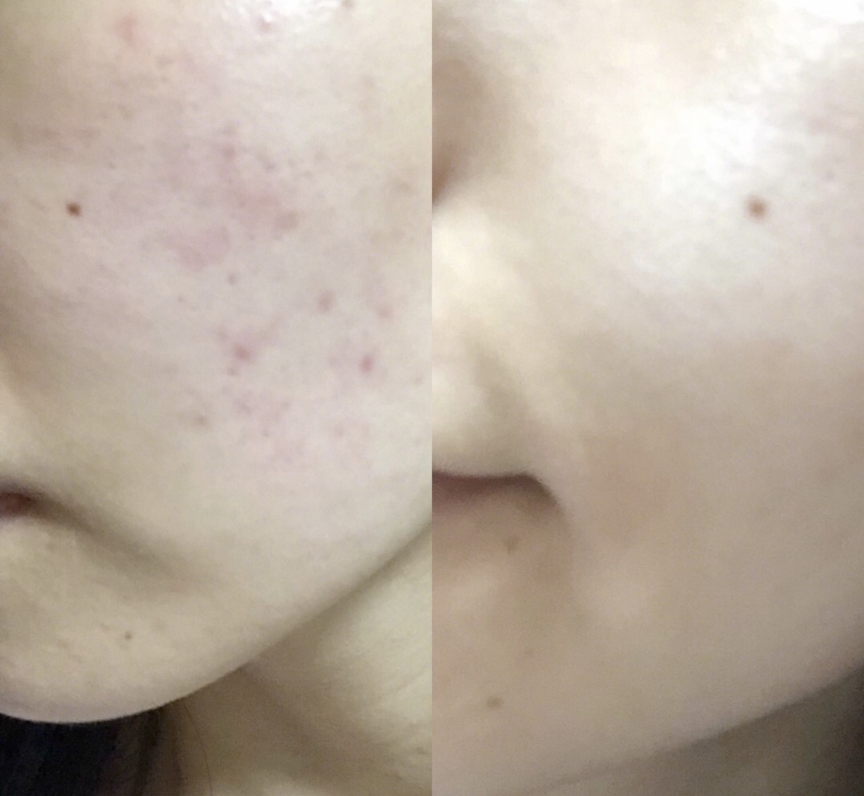 浼婁附鑾庣櫧闆呴】鐪奸儴娣″寲缁嗙汗,娣″寲缁嗙汗绮惧崕浼婁附鑾庣櫧闆呴】