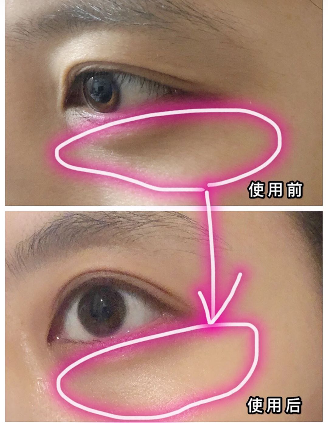 老婆种了睫毛,老婆种睫毛