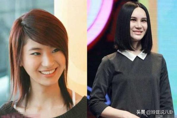 有哪些明星过度整容惨不忍睹,整容失败女明星今昔对比