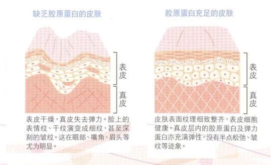 激光美白祛斑淡化斑点并去除皱纹,牙齿内源性变色用激光美白有用吗