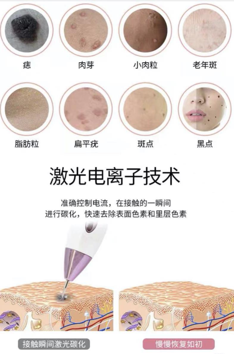 自己买激光笔点痣安全吗,家用激光笔点痣