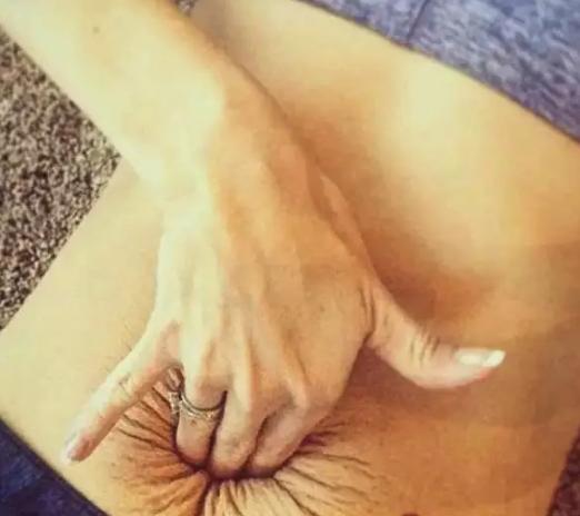 产后肚皮像橘子皮一样,产后肚子圆圆的像个球