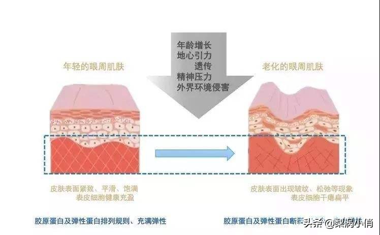保湿眼霜排名十大公认好用的眼霜,十大公认好用的眼霜26岁