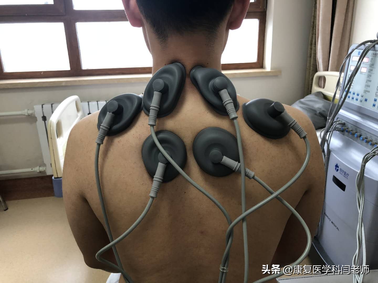 康复理疗中频治疗,中频电疗仪对偏瘫康复的作用