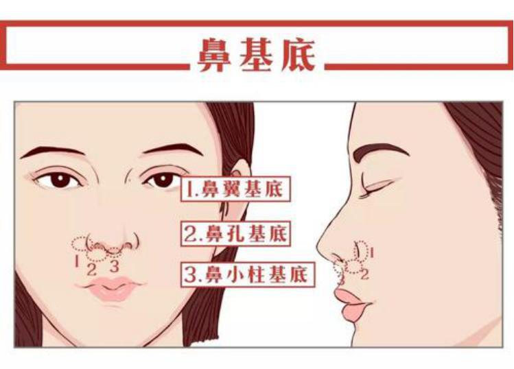 有法令纹眼袋深显老怎么办,有法令纹怎么打腮红不显老