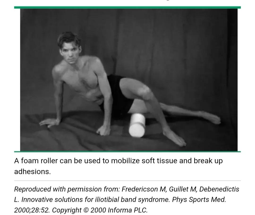 这个伤让他连续三年无缘马拉松！其实1/10的跑者都在被它折磨！