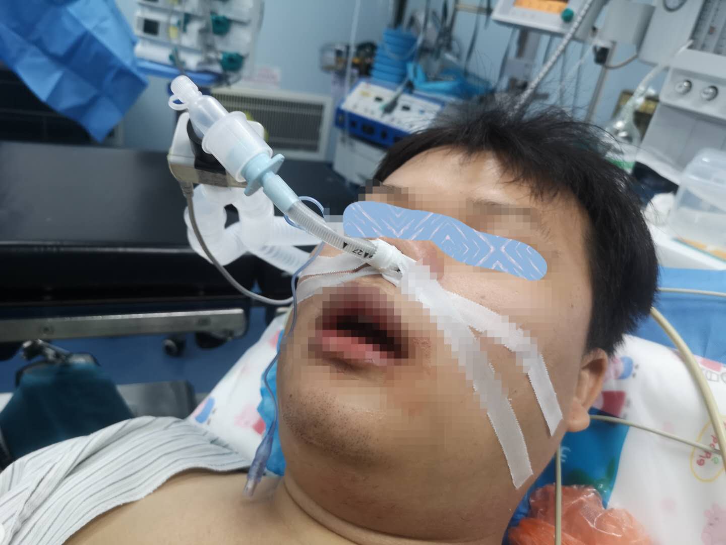 26岁小伙腰腿痛,男子51岁两胯痛是怎么回事