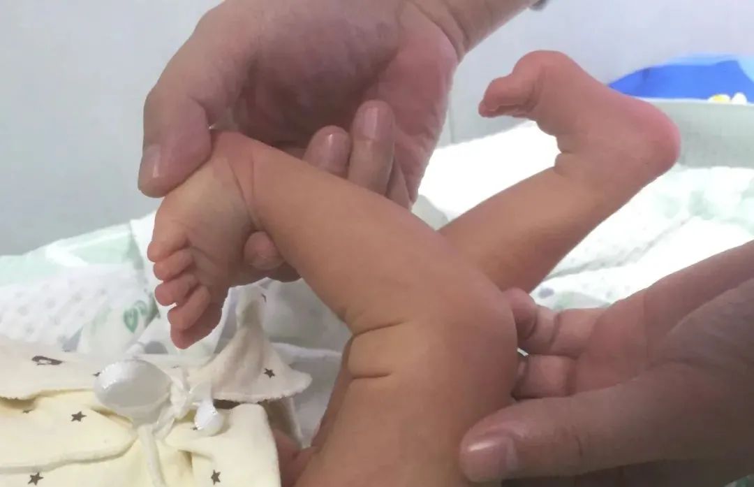 带您了解不一样的小儿骨科,小儿骨科医生在线问诊