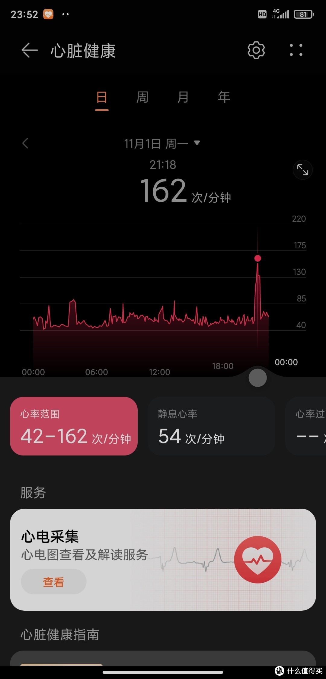RedmiWatch2璇勬祴,redmiwatch2鍜寃atch1鍖哄埆
