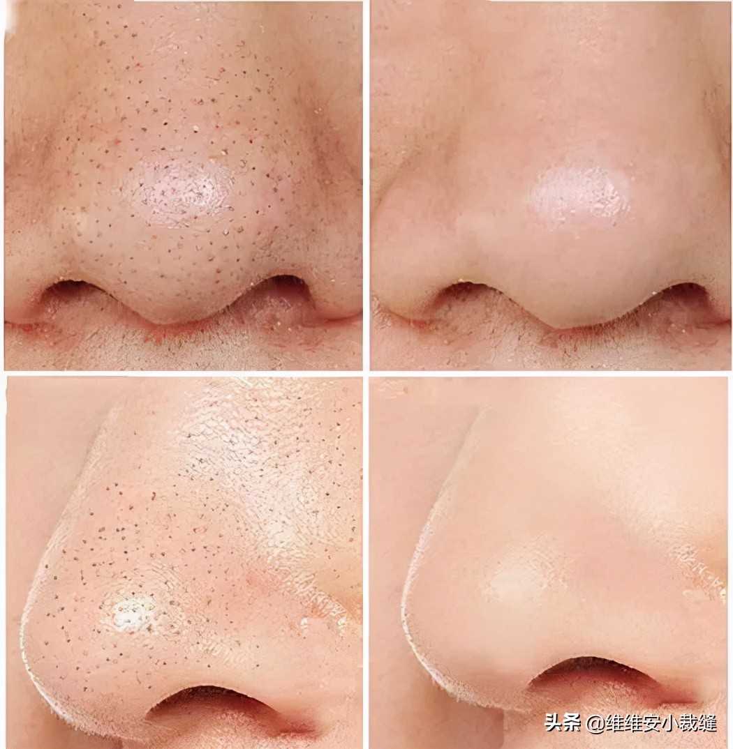 美颜磨皮拯救不了,毛孔粗大磨皮教程