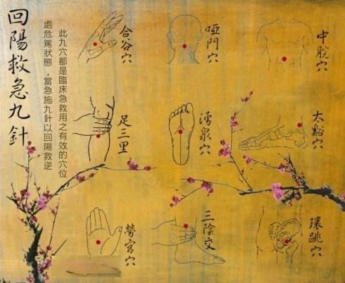 针灸必背十首歌曲,十大针灸歌诀配方集锦