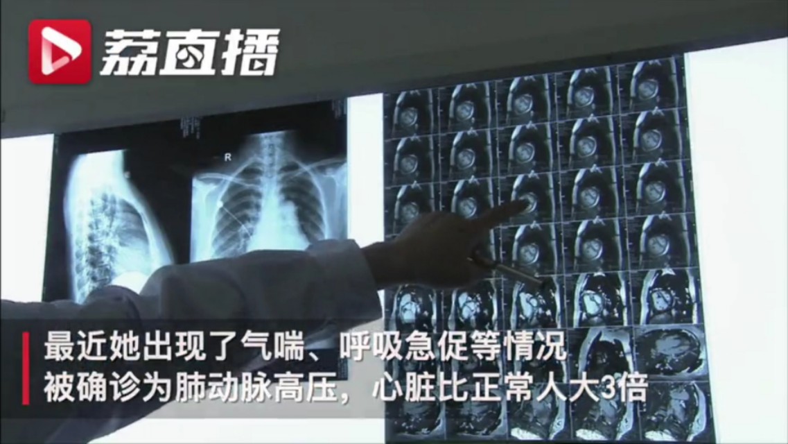 十年吃了三十种减肥药,10年吃三十多种减肥药