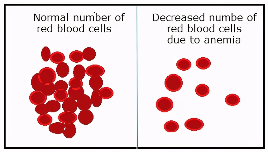 叶酸和维生素b6能治贫血吗,缺b6吃什么能补得快
