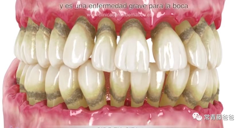 爱牙日保护你的口腔健康,爱牙日从定期口腔检查开始