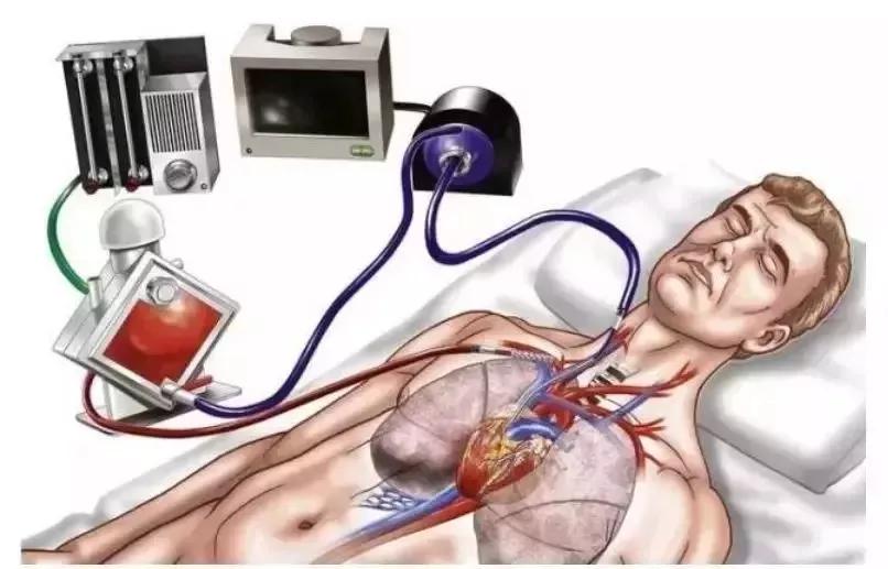 拉个肚子，心跳却突然没了！深圳“包租婆”为此两进ICU