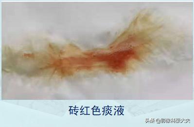 新冠肺炎对癌症有影响吗,癌症晚期肺炎怎么治疗