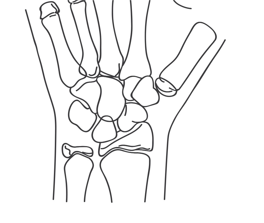 孩子身高发育过程中的四个雷区,婴儿身高生长发育规律