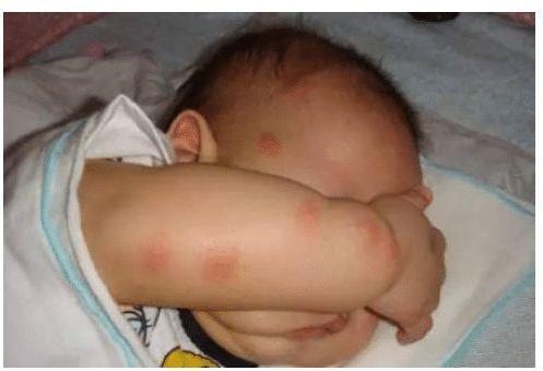 耳朵里面有蚊子嗡嗡响怎么解决,晚上睡觉蚊子嗡嗡响一招解决