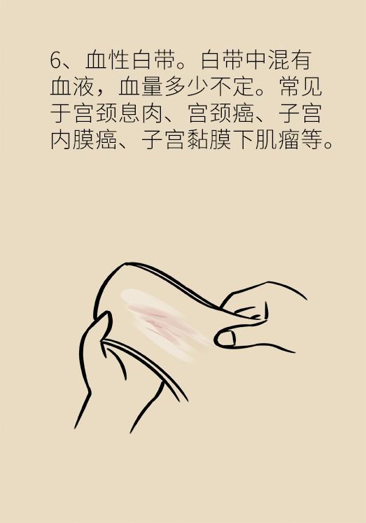 女性容易出现的一些高发病,很多女生都有的小问题