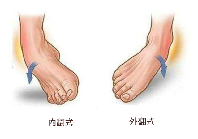 崴过一次脚很容易再次受伤,孩子第一次崴脚你重视了吗