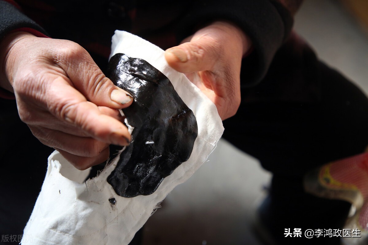 男子怪病脖子穿孔吃啥漏啥，神医还来骗钱，最终找我：被误诊25年