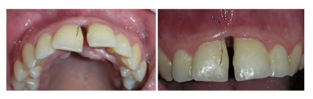 睫毛真的可以长长吗,睫毛一直在眼睛里有什么影响吗