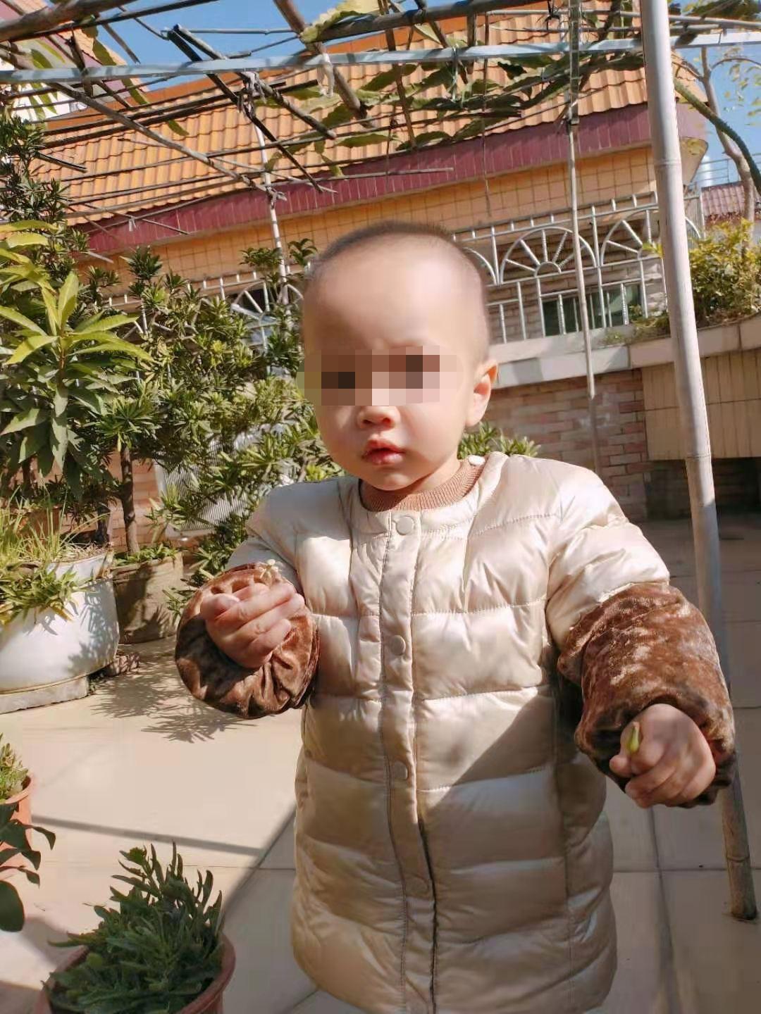 肺炎之下，我的疳积宝宝养护之路分享