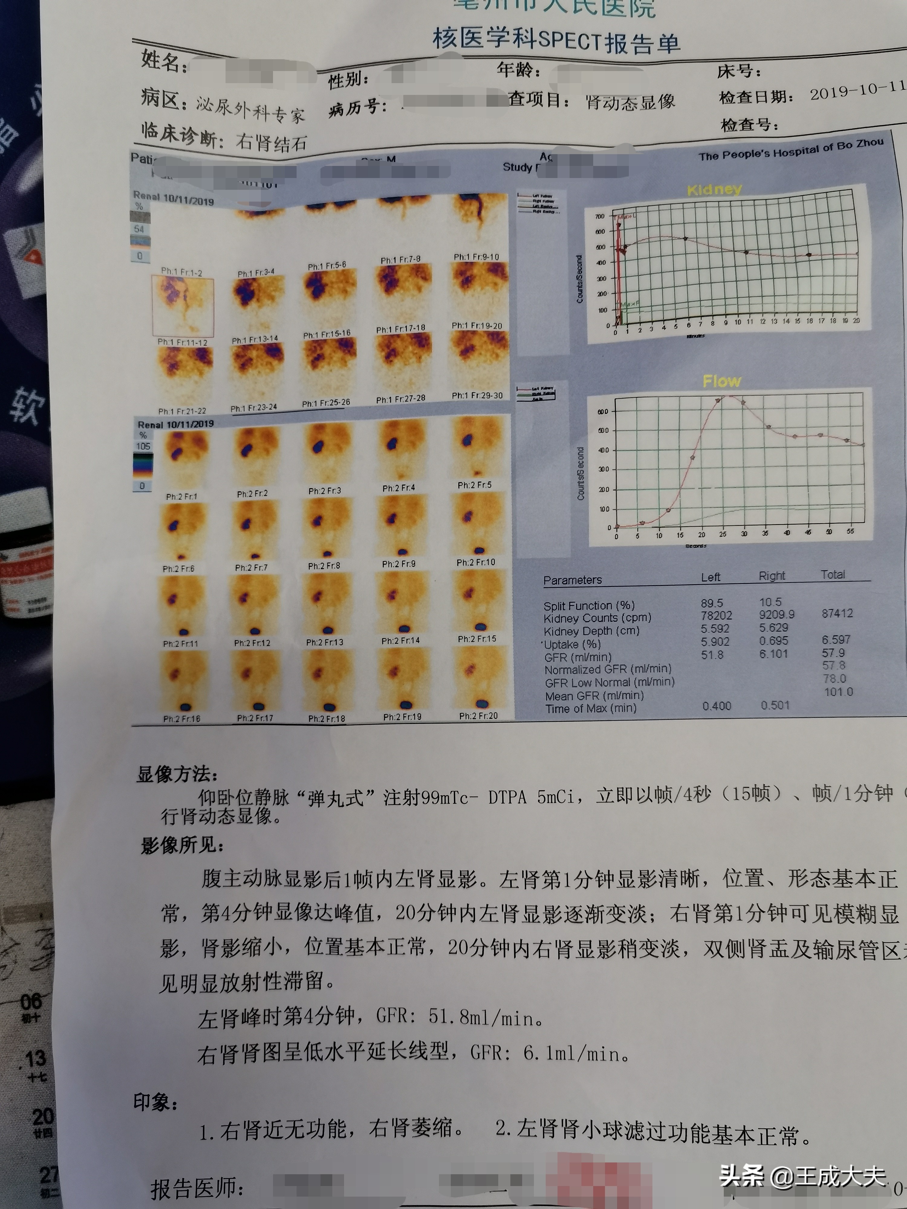 关于尿路结石的病因说法不正确,结石方面辟谣