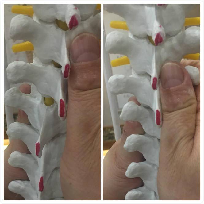 颈椎病脑供血不足的最好治疗方法,椎动脉颈椎病的症状和治疗方法