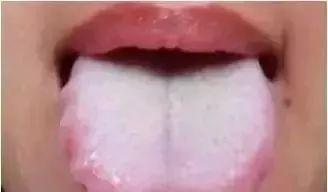 胃部尤其怕冷,胃部畏寒怕冷是什么原因