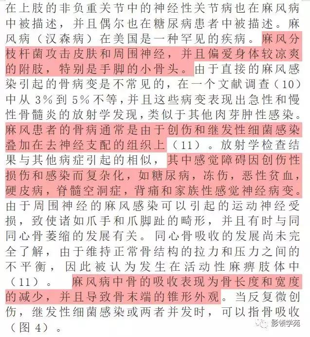 神经性骨关节病,神经性关节炎症状图片