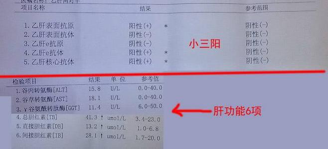 女性得乙肝小三阳,女子10年后确诊肝硬化中晚期