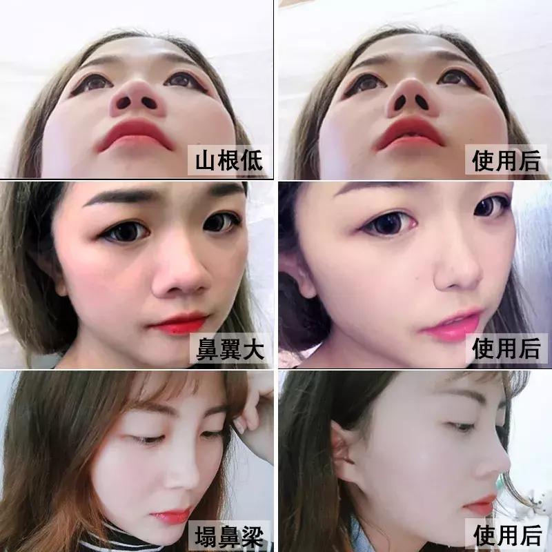 网红隆鼻精油有用吗,揭穿精油骗局