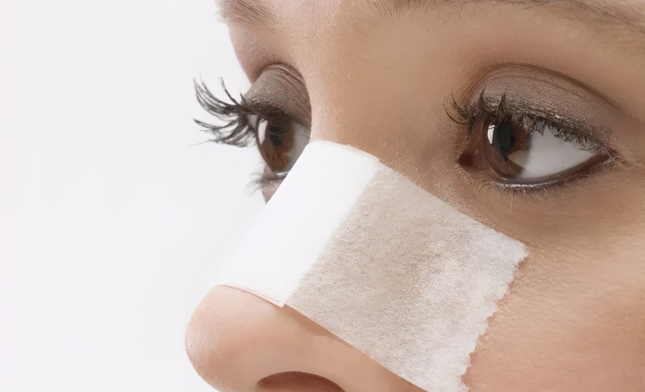 鼻子毛孔粗大怎么快速解决,鼻子毛孔粗大怎么变小一点