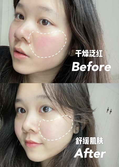 换季护肤面霜大牌,换季护肤大作战视频