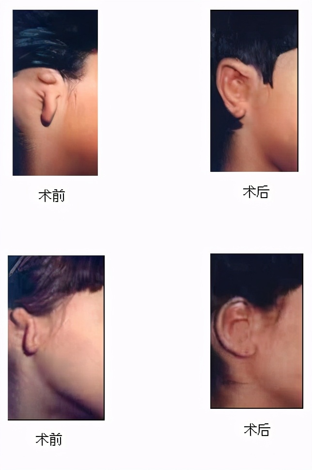 孩子六岁了父母应该注意哪些,小耳畸形的孩子要生吗