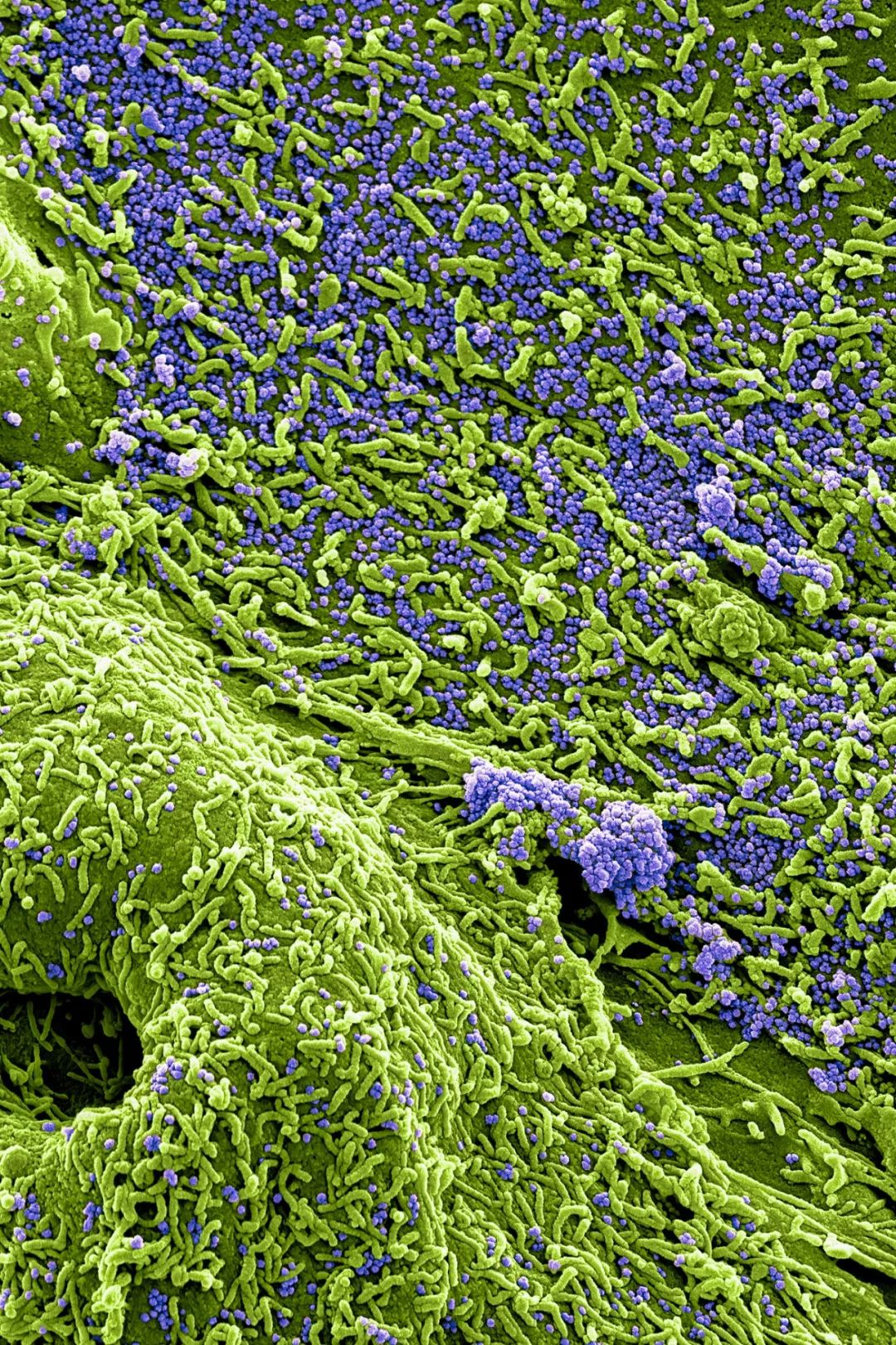 医生和病毒作战,我们如何对付病毒