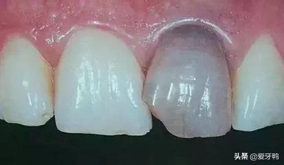 小孩被牙齿磕到头怎么办,小孩磕到牙齿出血怎么办